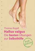 Hallux valgus