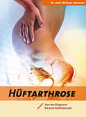 Hüftarthrose