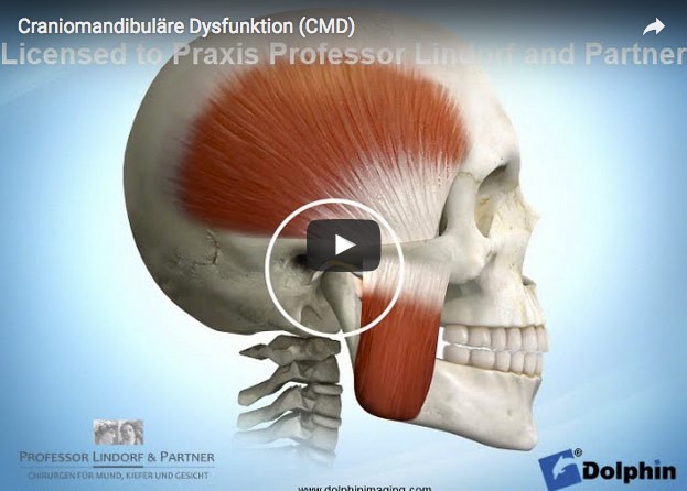 Craniomandibuläre Dysfunktionen (CMD) | gesundheit.com