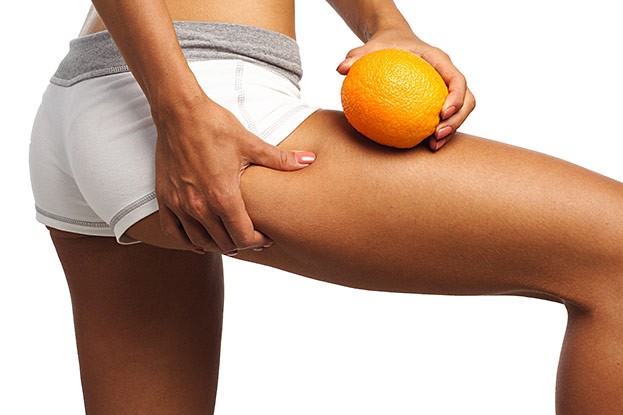 Sport ist die wichtigste Therapie bei Cellulite. Er steigert die Durchblutung und hilft das Fett abbauen.