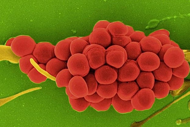 Gehört zu den gefürchteten Krankenhauskeimen: Staphylococcus aureus
