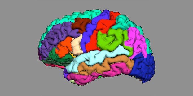 Die Anatomie unseres Gehirns kann Hinweise auf die Entstehung von Psychosen liefern