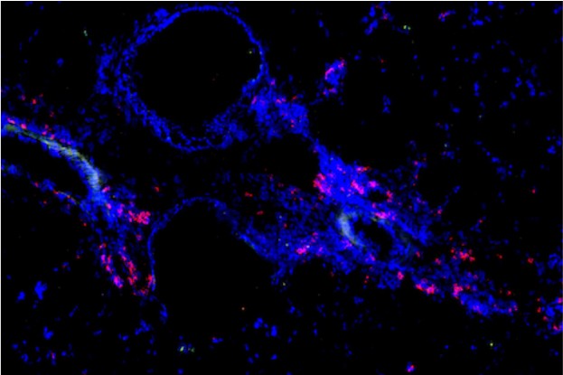 T-Speicherzellen(rot), die auf Allergene reagieren, die zu einem Asthmaanfall führen. Das Blau zeigt die Lungenstruktur