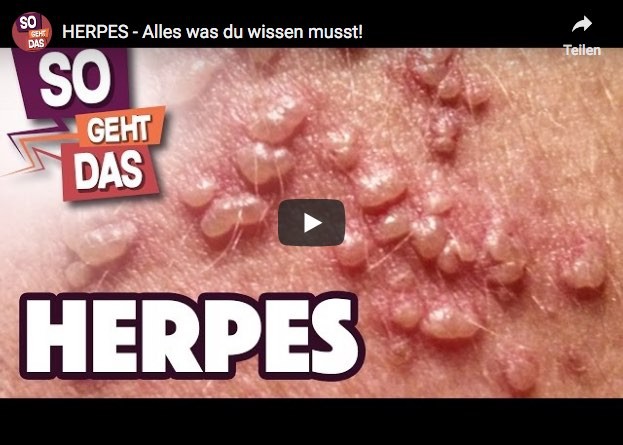 Herpes im intimbereich