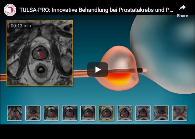 Prostataerkrankungen-Vorbeugung und Erkennung | gesundheit.com