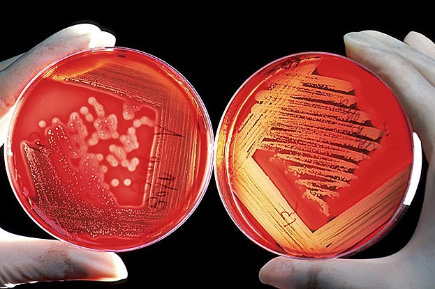Mithilfe von Bakterienkulturen lassen sich im Labor die Bakterien, die einer Erkrankung zugrunde liegen, bestimmen, um sie dann gezielt zu behandeln.