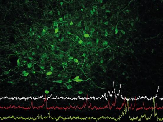 Nervenzellen im Hypothalamus (grün gefärbt) steuern nicht nur das Fressverhalten, sondern auch die soziale Interaktion 