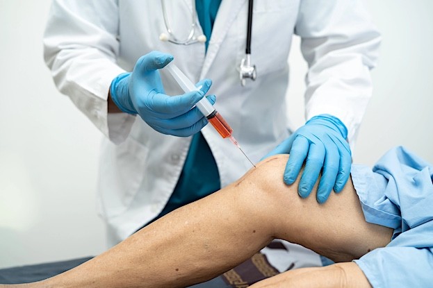 Hyaluronsäure bei Arthrose