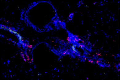 T-Speicherzellen(rot), die auf Allergene reagieren, die zu einem Asthmaanfall führen. Das Blau zeigt die Lungenstruktur - ©Uni Wien