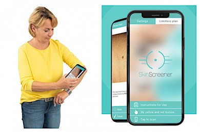 Hautkrebsvorsorge leicht gemacht mit der App SkinScreener - ©medaia GmbH