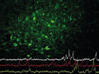 Nervenzellen im Hypothalamus (grün gefärbt) steuern nicht nur das Fressverhalten, sondern auch die soziale Interaktion  - ©Universität zu Köln_Anne Petzold