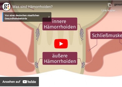 Hämorrhoiden - Gesundheitsportal Bund