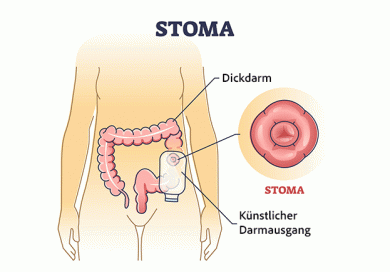 Stoma - ©VectorMine by Depositphotos