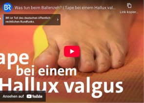 Hallux Valgus - Bayerischer Rundfunk