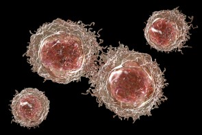 Krebszellen - ©Katerynakon by Depositphotos