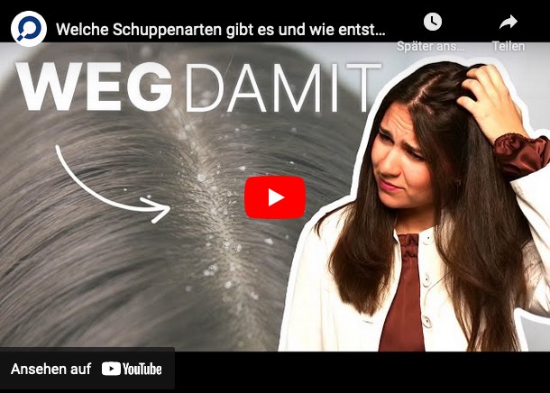 Schuppen sind nicht gleich Schuppen