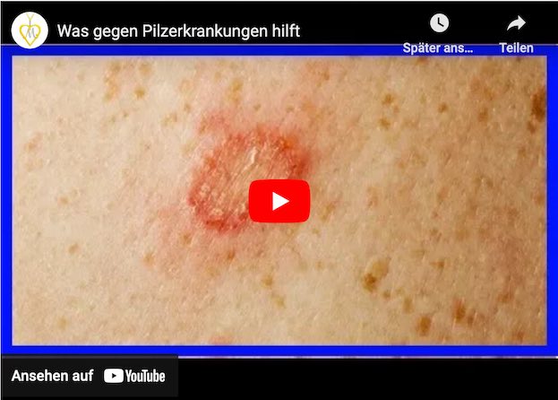 Video-Vorschau
