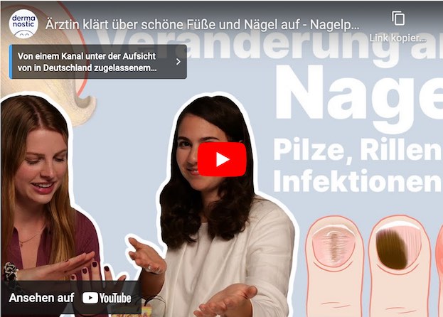 Nagelpilz oder Onychomykose