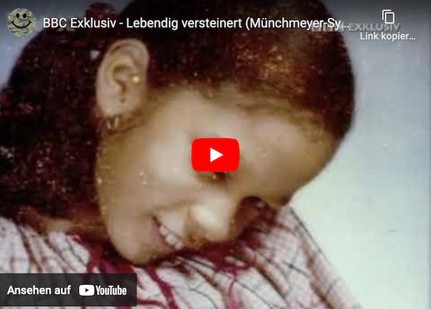 Fibrodysplasia (FOP): Wenn aus Muskeln Knochen werden