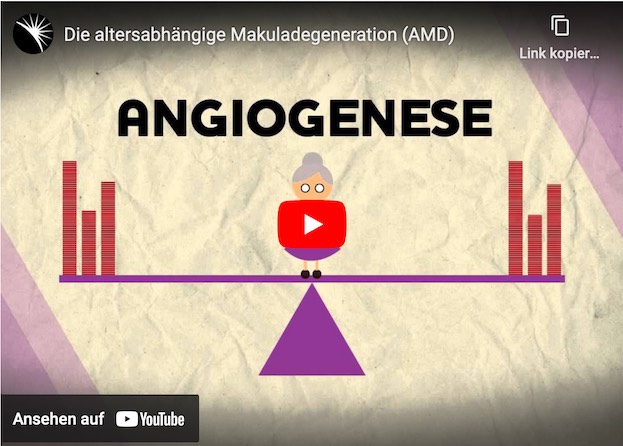Ist Altersbedingte Makuladegeneration (AMD) bald heilbar?