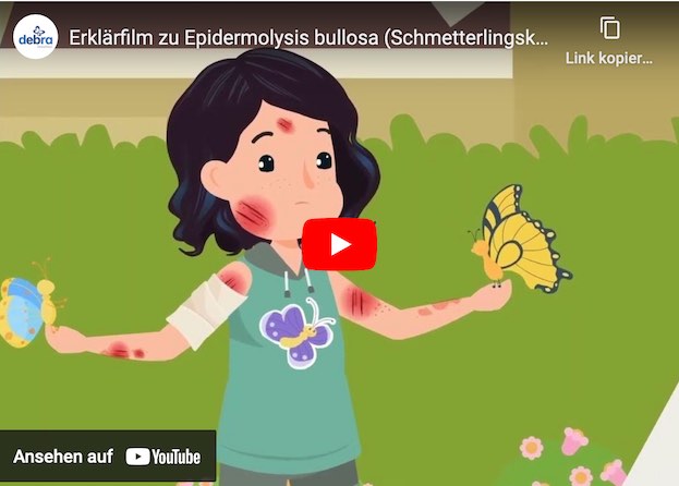 Schmetterlingskrankheit - Epidermolysis bullosa (EB)