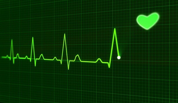 EKG zeigt wichtige Herzdaten