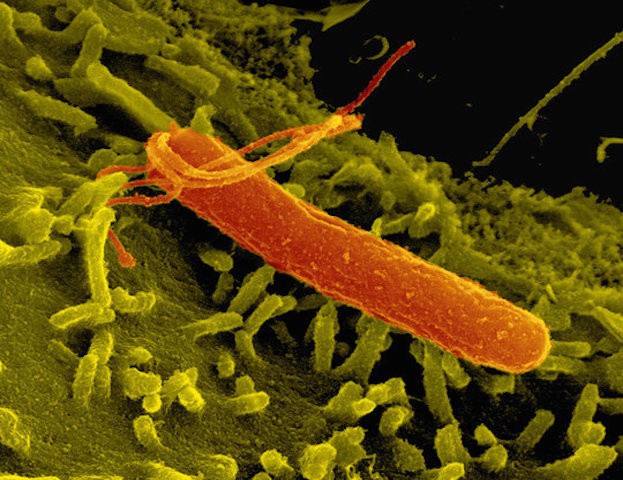 Magenbakterium Helicobacter Pylori 