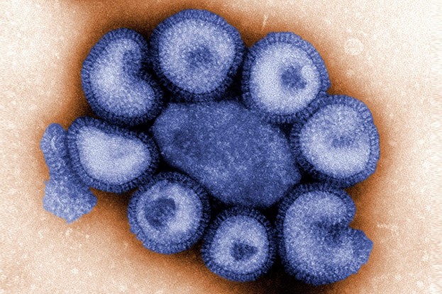 Virus Teilchen blau eingefärbt (PDCC0)
