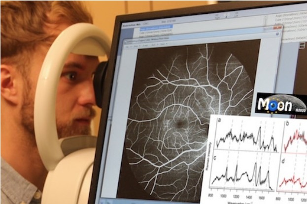 Das Forscherteam baut ein Gerät, an dem Patientinnen und Patienten ihr Auge berührungsfrei abrastern lassen können und wenige Minuten später eine Diagnose erhalten. 