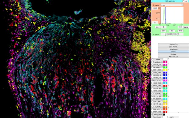 Fluoreszenzaufnahme von verschiedenen Immunzellen bei der Reparatur des verletzten Ischiasnerven