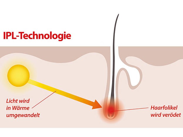 IPL Technologie