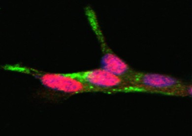 Validierung von PDX1, einem Transkriptionsfaktor der sich oberhalb der T2D-Inselsignaturgene befindet. - ©Solimena/Diabetologia.