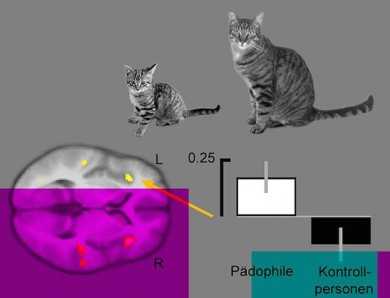 Die Betrachtung von Jungtieren im Vergleich zu ausgewachsenen Tieren löst bei pädophilen Männern verstärkte Aktivität in verschiedenen Hirnarealen aus (gelbe Flächen). - ©Dr. Jorge Ponseti