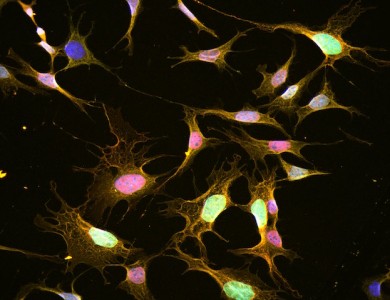Der Wirkstoff Celastrol stellt die Leptin-Sensitivität im Gehirn wieder her - ©Helmholtz Zentrum München