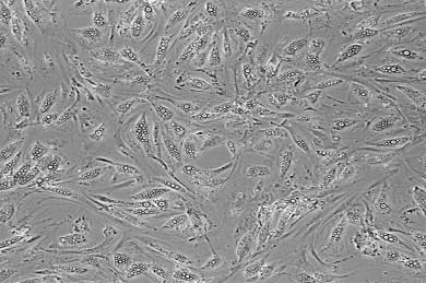Mikroskopische Aufnahme von humanen Adipozyten, in denen sich Lipidtropfen (weiß) ansammel - ©DIfE