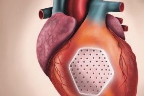 ©Sanofi_BrickenkampPR